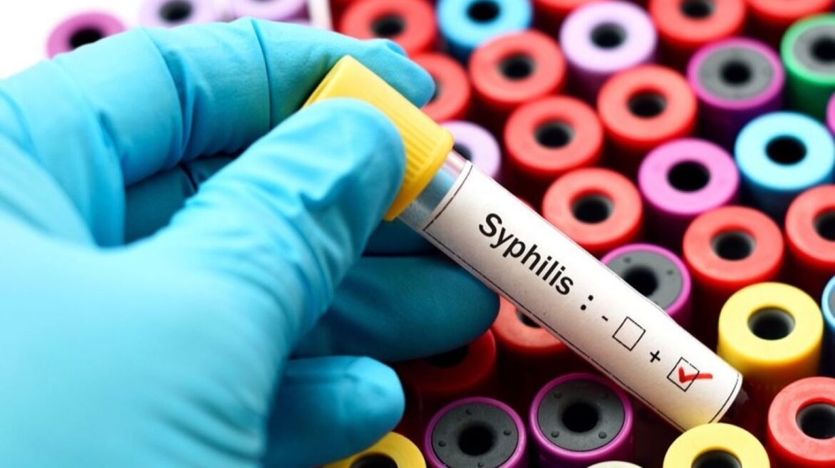 Diagnóstico precoce é fundamental para restringir o avanço da sífilis