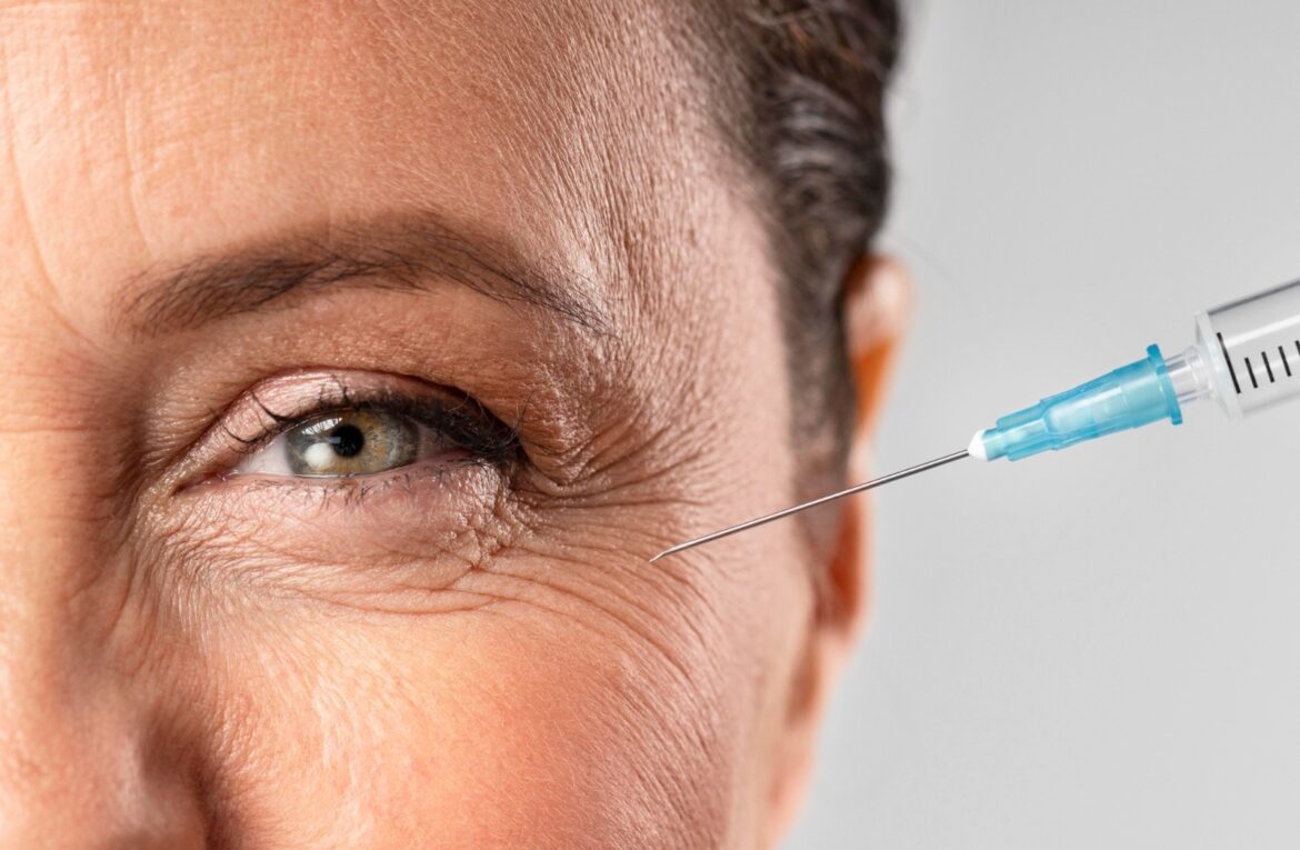 Botox além da estética - Reprodução