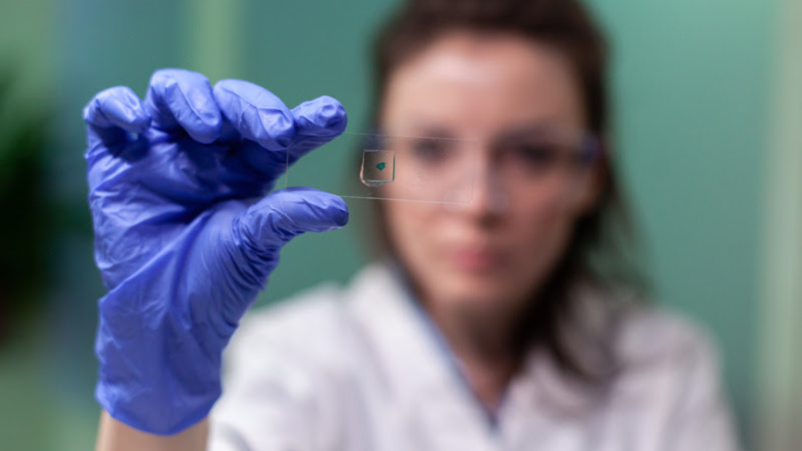 Eficaz na detecção precoce do câncer de colo de útero, genotipagem do HPV deve ser feita a partir dos 25 anos